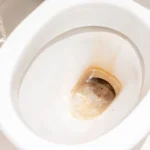 Kako se Riješiti Kamenca…